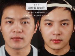 -北京米扬丽格医疗美容·联合丽格鼻整形中心