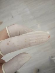 -苗医生草本科技祛痘