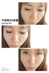 睫毛嫁接-光SPA科技美肤