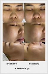-E.beauty驻颜·痘敏肌调理中心