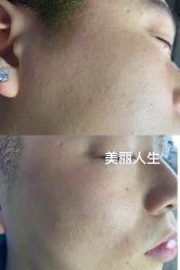 -爱莎扁平疣·汗管瘤·斑痣中心