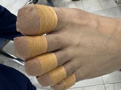-Andrew指甲专科灰指甲·甲沟炎矫正·3D步态矫形鞋垫定制(浦三路店)