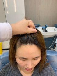 -大麦微针植发全国连锁