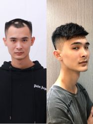 -发饰美男士增发补发假发定制店