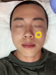 -清疣美疣·痣·斑净肤中心