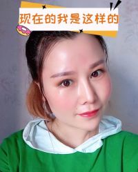 -素美医疗美容·西南眼鼻整形·修复基地