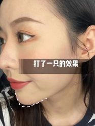 -上海伊莱美医疗美容医院
