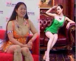 -香薇妮丝女子减肥院