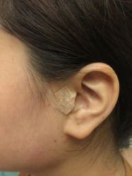-肥三针腧穴瘦身馆