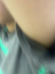 -美瑞莎创美医疗美容