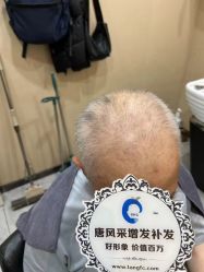 -唐风采假发补发定制