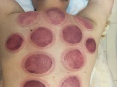 -张钰强中医正骨推拿连锁(华发商都店)