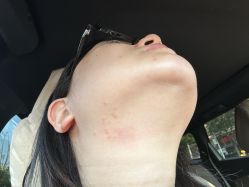 -小忠丽格医美