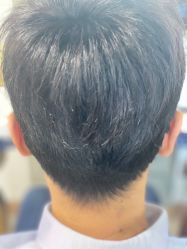 点击看大图 -极客侠男士假发定制补发