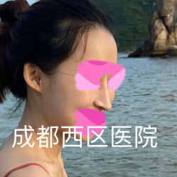 -成都西区医院整形美容