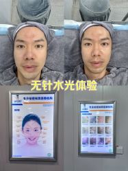 -北京豆豆博士专业祛痘