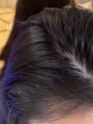 -碧莲盛·不剃发植发