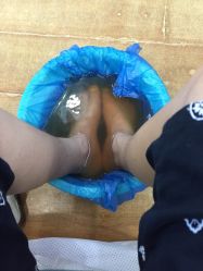iphone_upload_pic-EPAI·灰指甲·甲沟炎·嵌甲护理