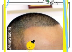 -大麦微针植发全国连锁