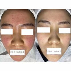 -美肤盾祛痘·问题肌头疗管理中心