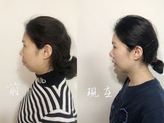 -柏乐口腔(南宁总院)