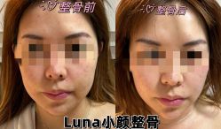-LUNA皮相美·骨相美高级美感