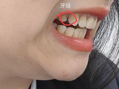 -团圆口腔·种植中心(锦江院区)