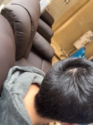 -碧莲盛·不剃发植发