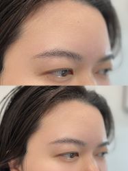 点击看大图 -张小野·专业半永久纹眉