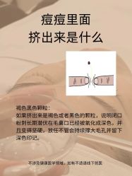 -克丽缇娜
