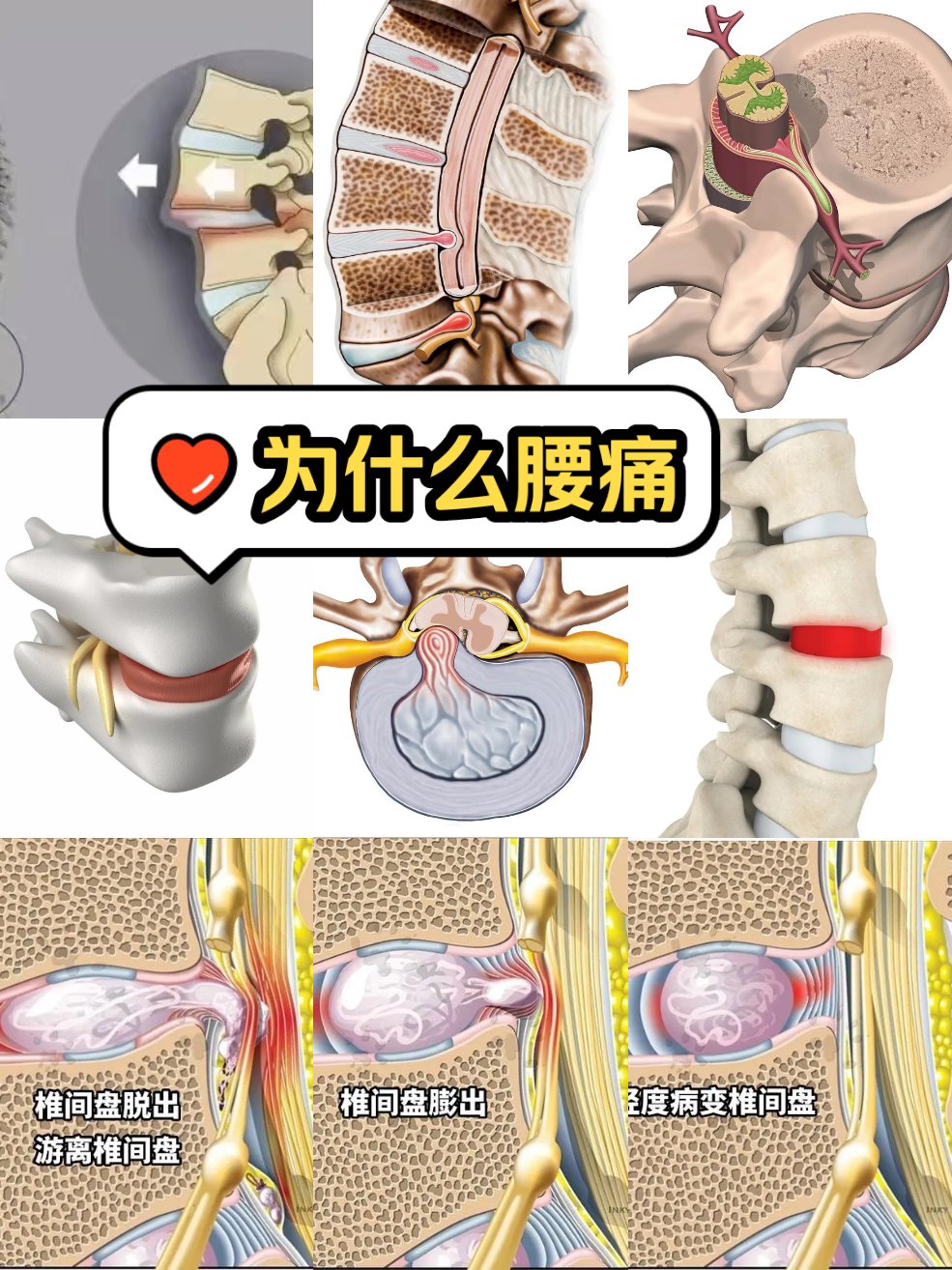 椎间盘丸功效图片