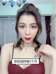 -大麦微针植发全国连锁