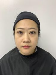 -广州健丽·去眼袋医疗美容机构
