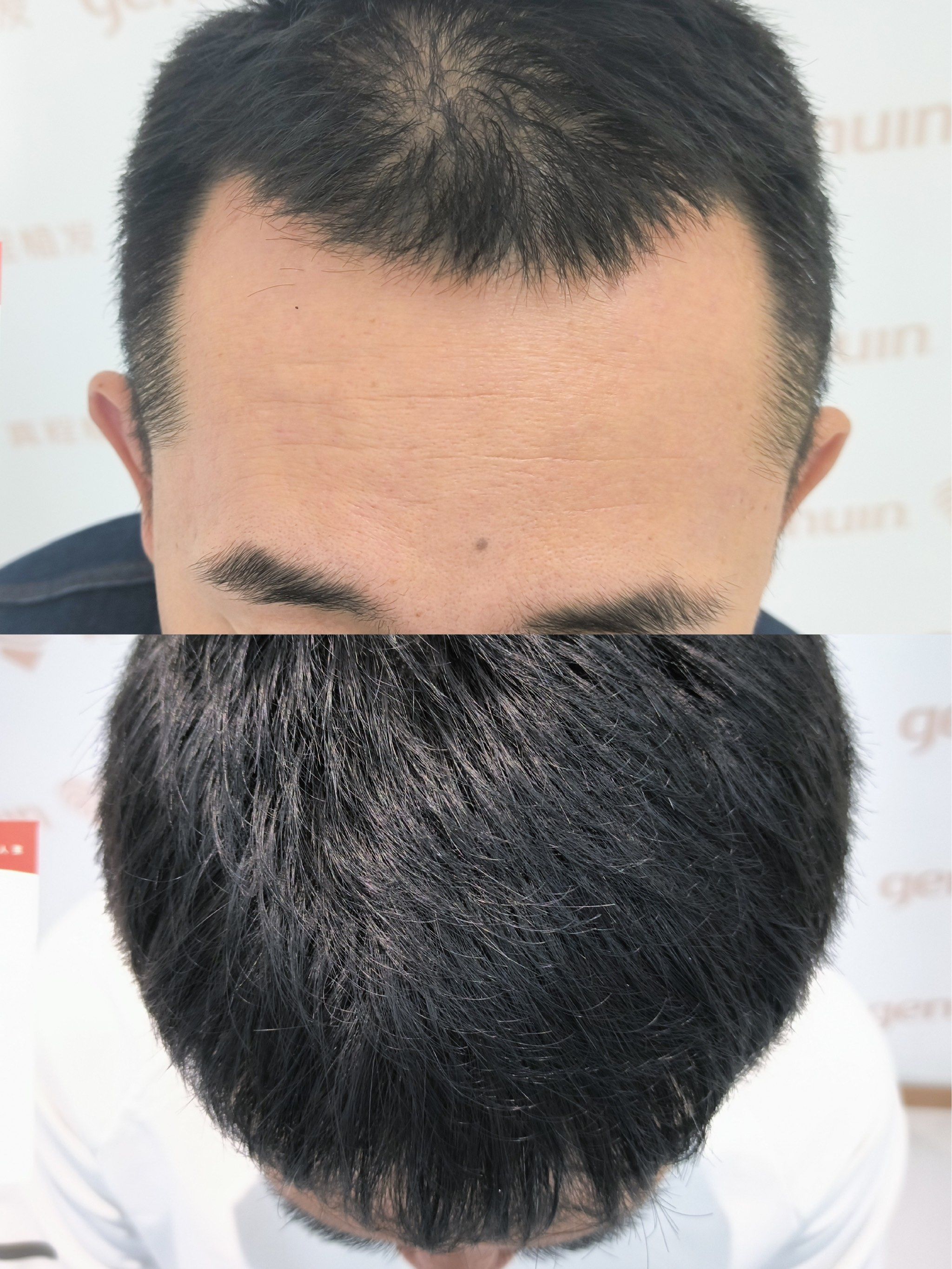 拜拜了,高发际线