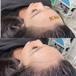 -RC半永久纹眉纹发际线