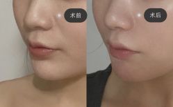 -上海漾颜医疗美容