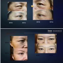 -安吉拉青春化管理中心