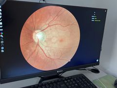 -宝岛眼镜(常熟珠江路欧尚店)