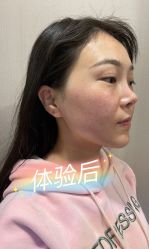 体验后-圣嘉新医疗美容医院