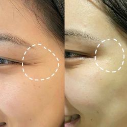 -来美轻医美抗衰中心