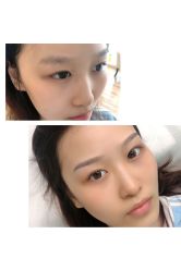 -久匠半永久纹眉