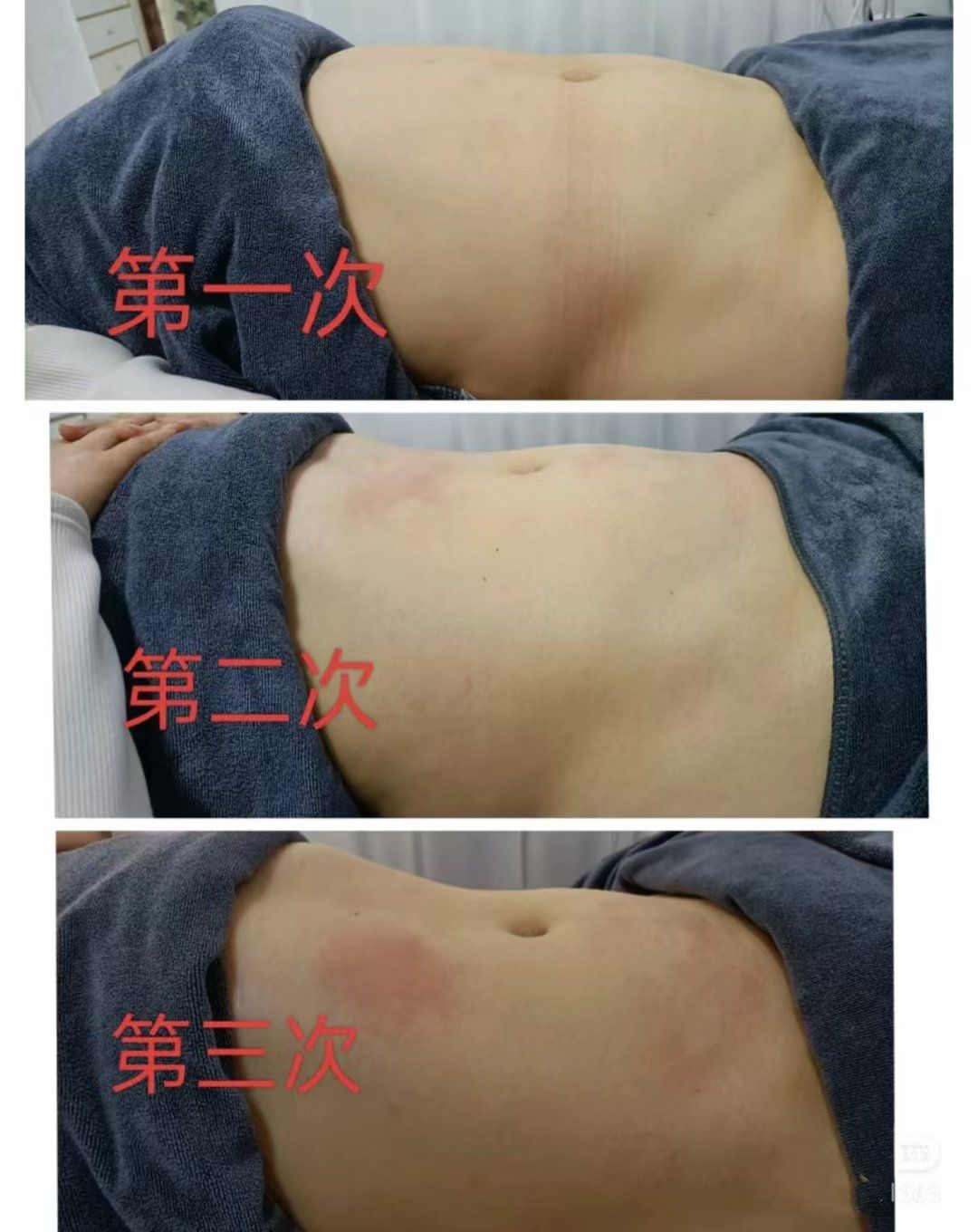 减肥塑形一定要做,身材曲线分钟改变 试想一下