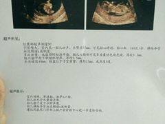 -川北医学院附属成都新华医院