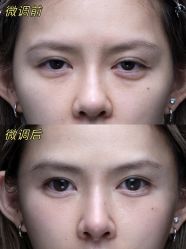 -深圳艺星医疗美容医院