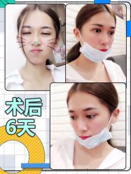-广东韩妃整形外科医院