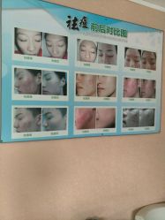 -苗方清颜专业祛痘连锁机构
