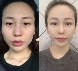 -上海伊莱美医疗美容医院