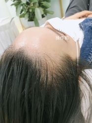 -MISS STAR·半永久纹眉·发际线·美瞳线