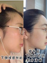 -厦门美莱整形美容医院