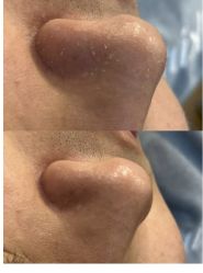 -SKIN79皮肤管理中心